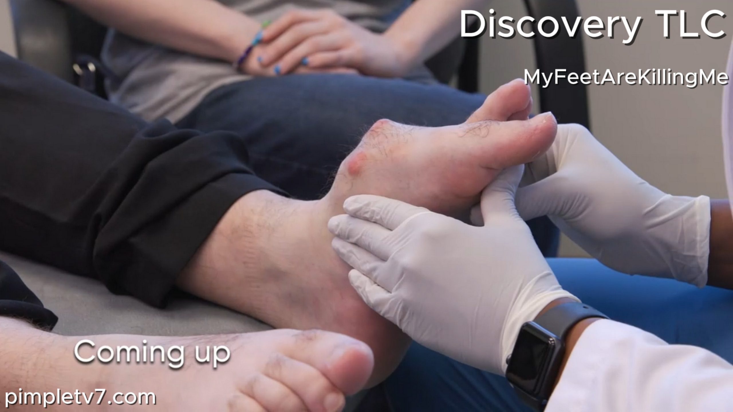 A man with a monstrous mystery growing on his foot. MyFeetAreKillingMe 270626