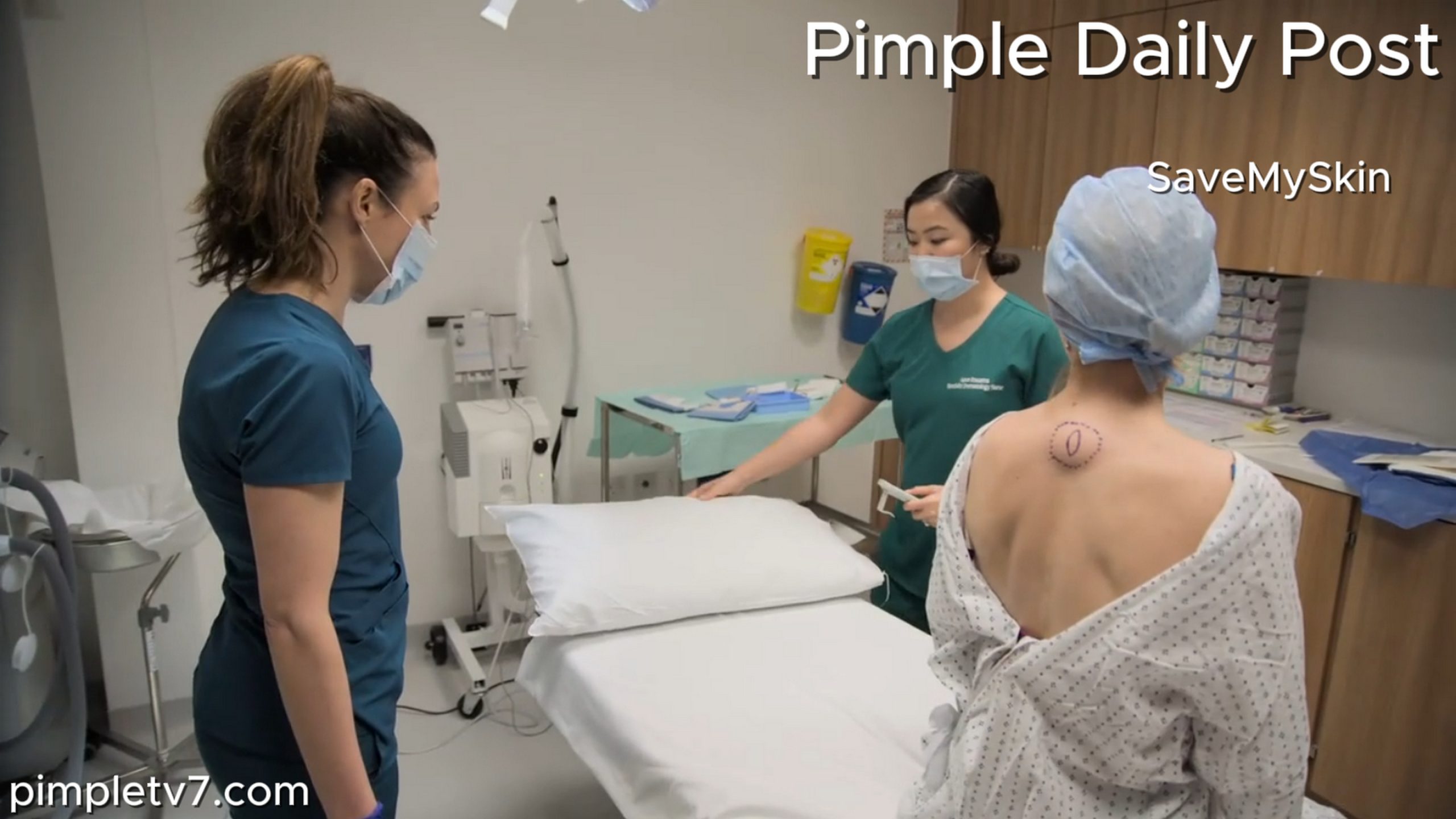 Amanda has an annoying lipoma on her back. SaveMySkin 150626