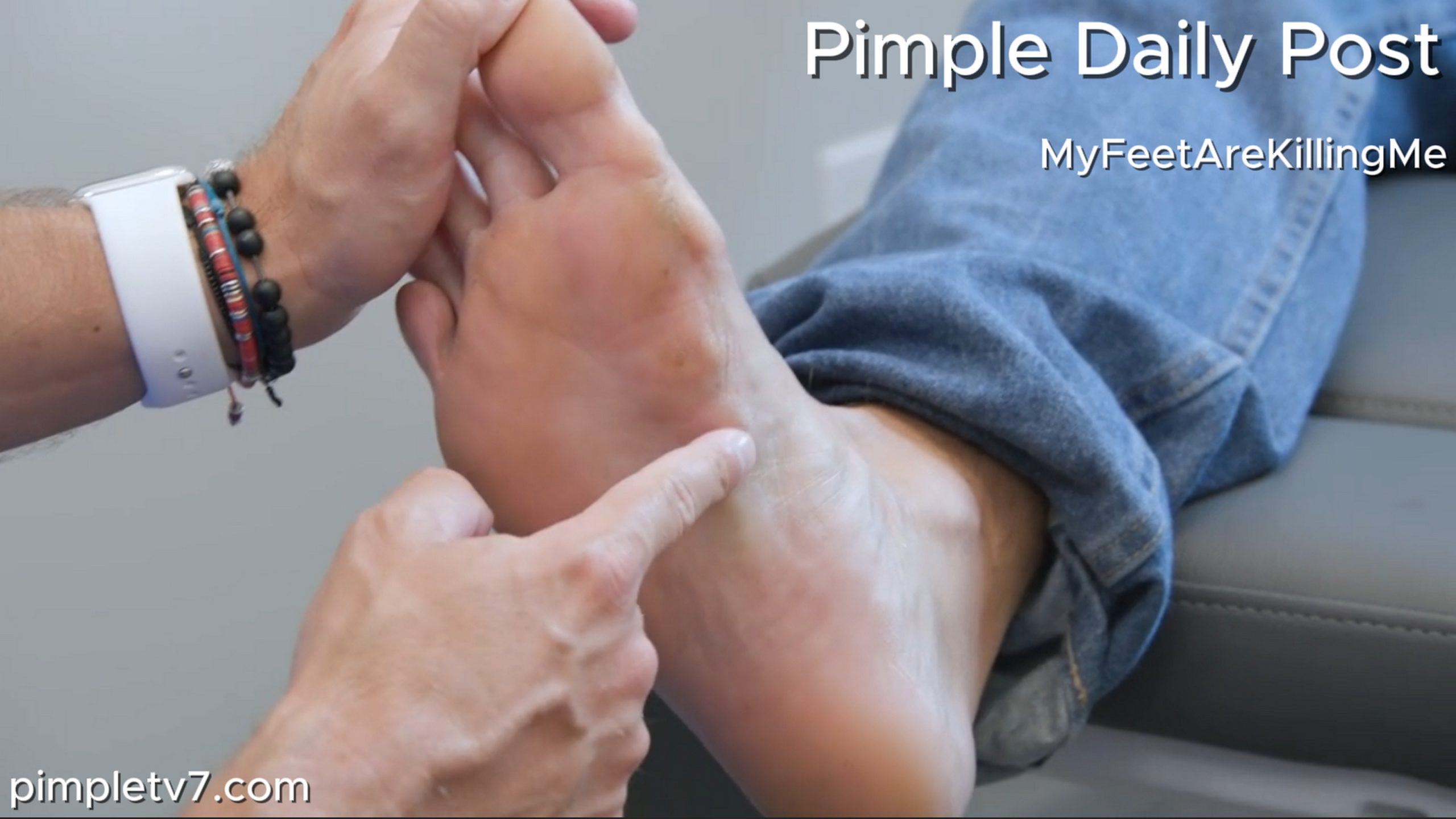 Dr. Brad helps a skateboarder with huge masses on the bottom of his foot that make it impossible to keep at his dream. MyFeetAreKillingMe 190626