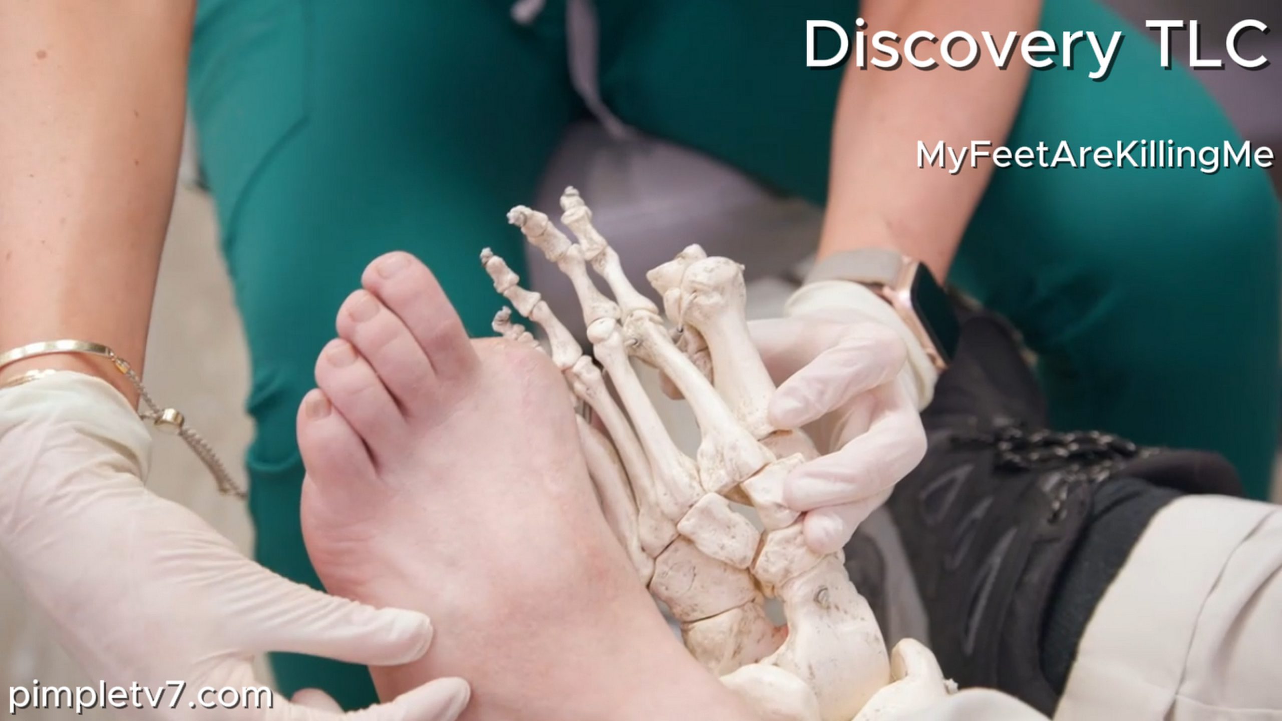 Dr. Sarah shakes the hand of a man with a big toe for a thumb. MyFeetAreKillingMe 240626