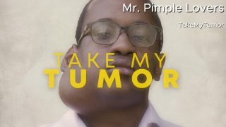 Fifteen-year-old Marcelo travels from Angola to Los Angeles to have a massive neck tumor removed, but the operation may be too risky. TakeMyTumor 140626