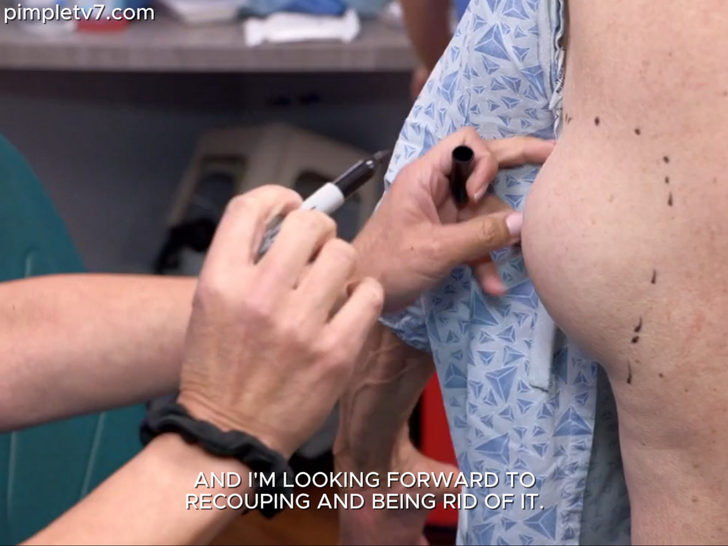 Dr. Sandra Lee: Johnny has been living with a lump on his back for too long. Dr. Pimple Popper 190626