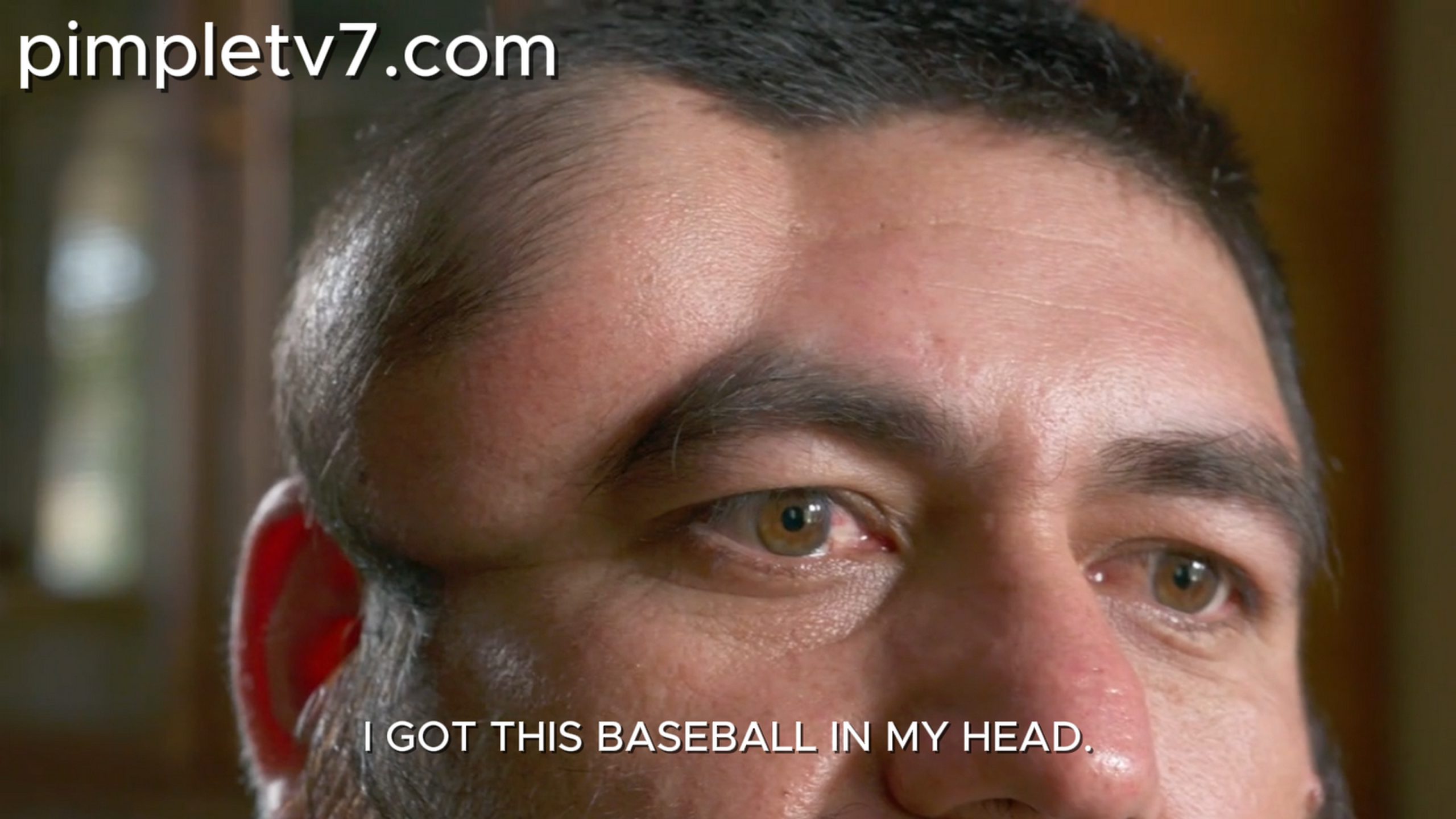 Jose never goes out because of the baseball-sized lump on his head. Dr. Pimple Popper 270626