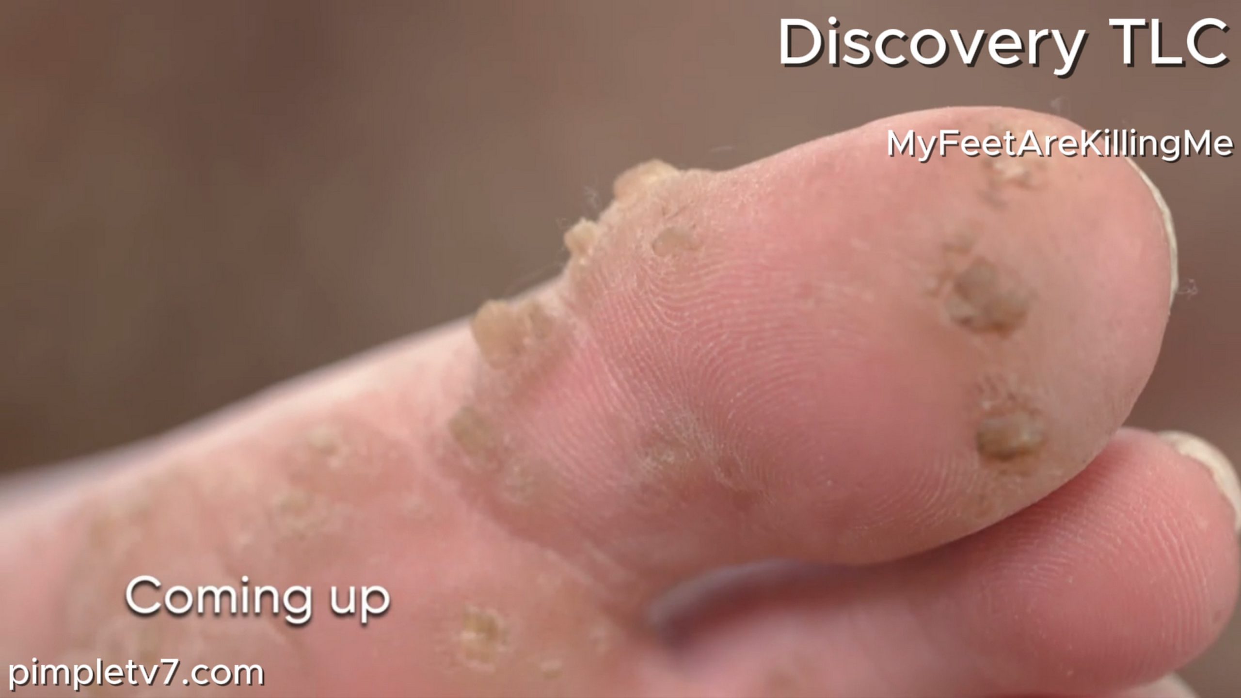 The doctors take on a man with a holy mystery. MyFeetAreKillingMe 280626