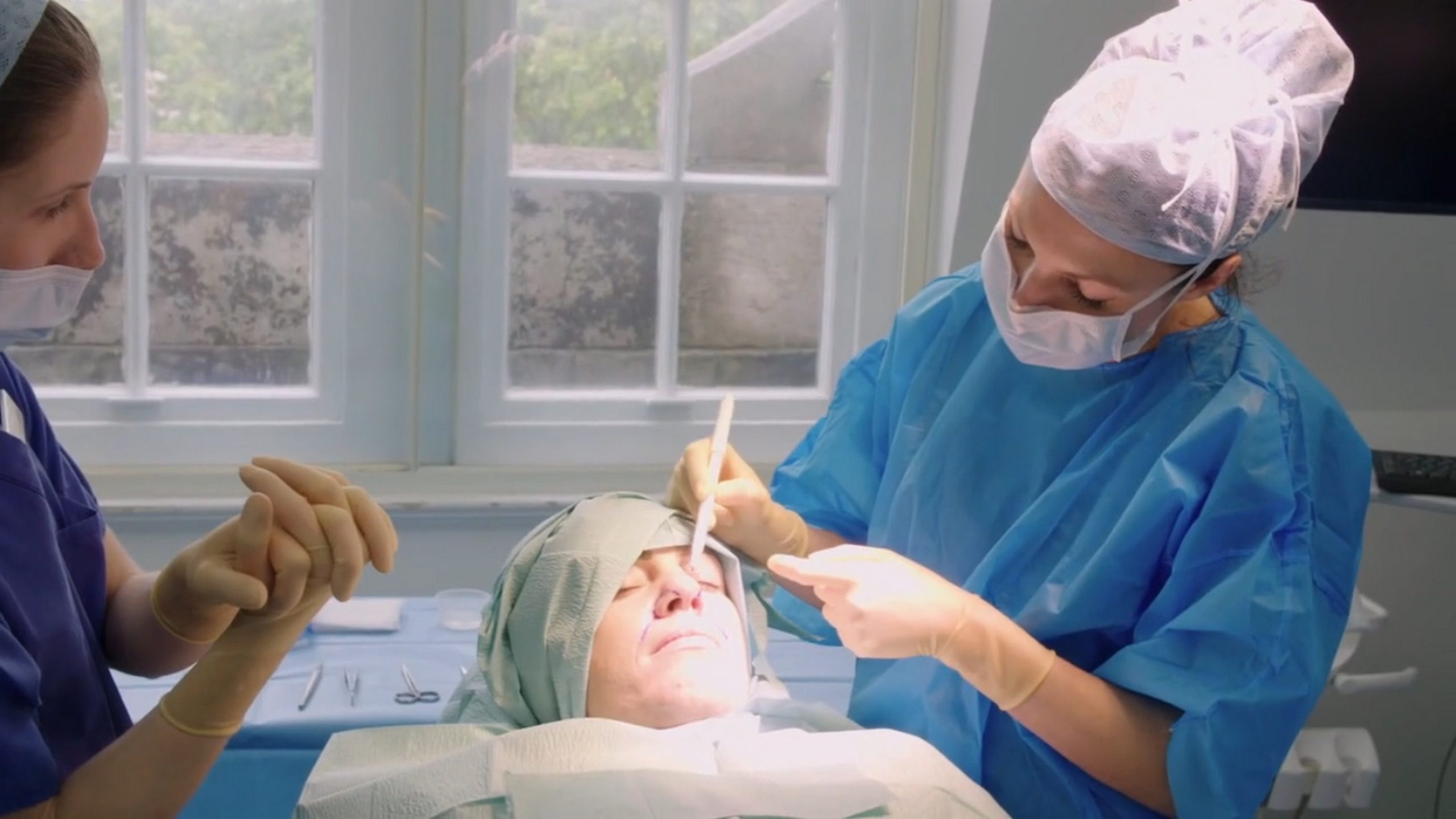 The growth on Traceyleanne’s nose is cause for concern. SaveMySkin 280626