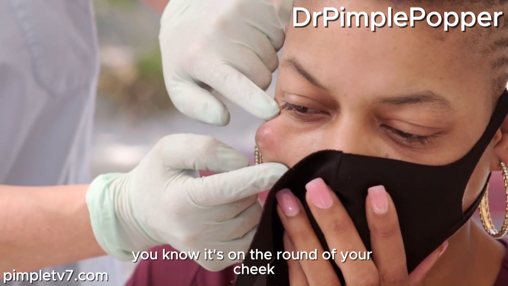 Che’Re, who has a prominent bump on her face that has put her in a dark place. Dr. Pimple Popper 240726