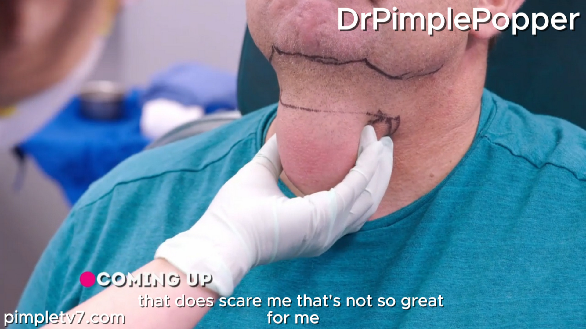 John fears the large lump on his neck could become so big that it may eventually suffocate him. Dr. Pimple Popper 270726