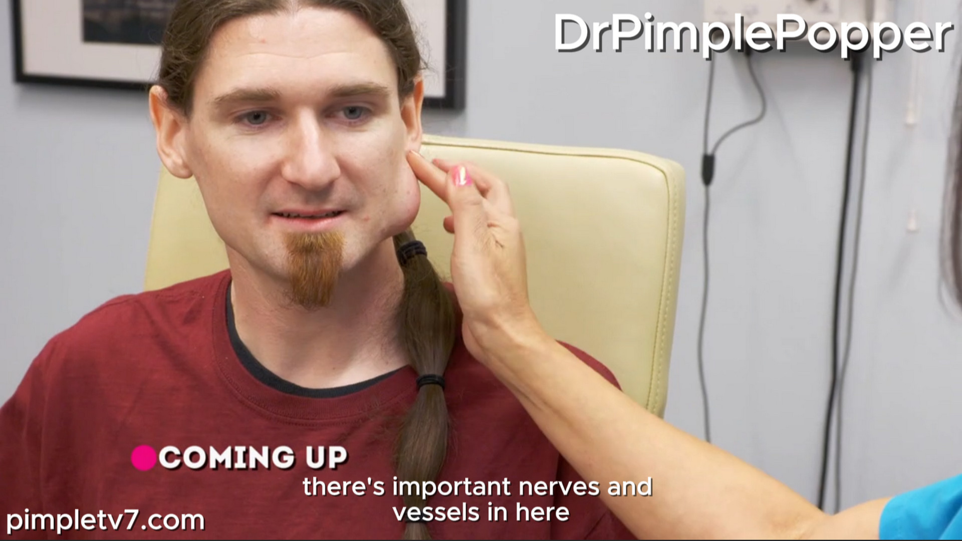Kevin had a bump that was on the side of his face about six to seven years ago. Dr. Pimple Popper 200726
