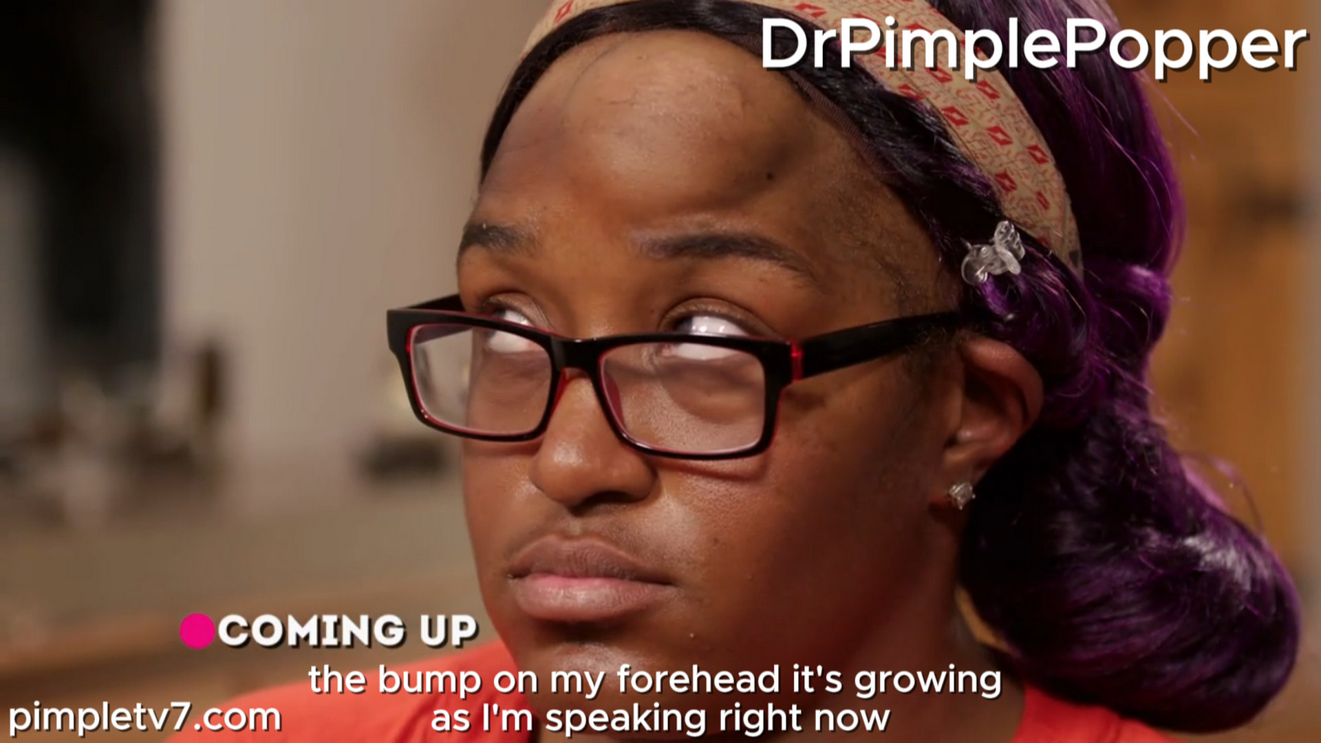 Shoshana is depressed because of the big growth on her forehead. Dr. Pimple Popper 280726