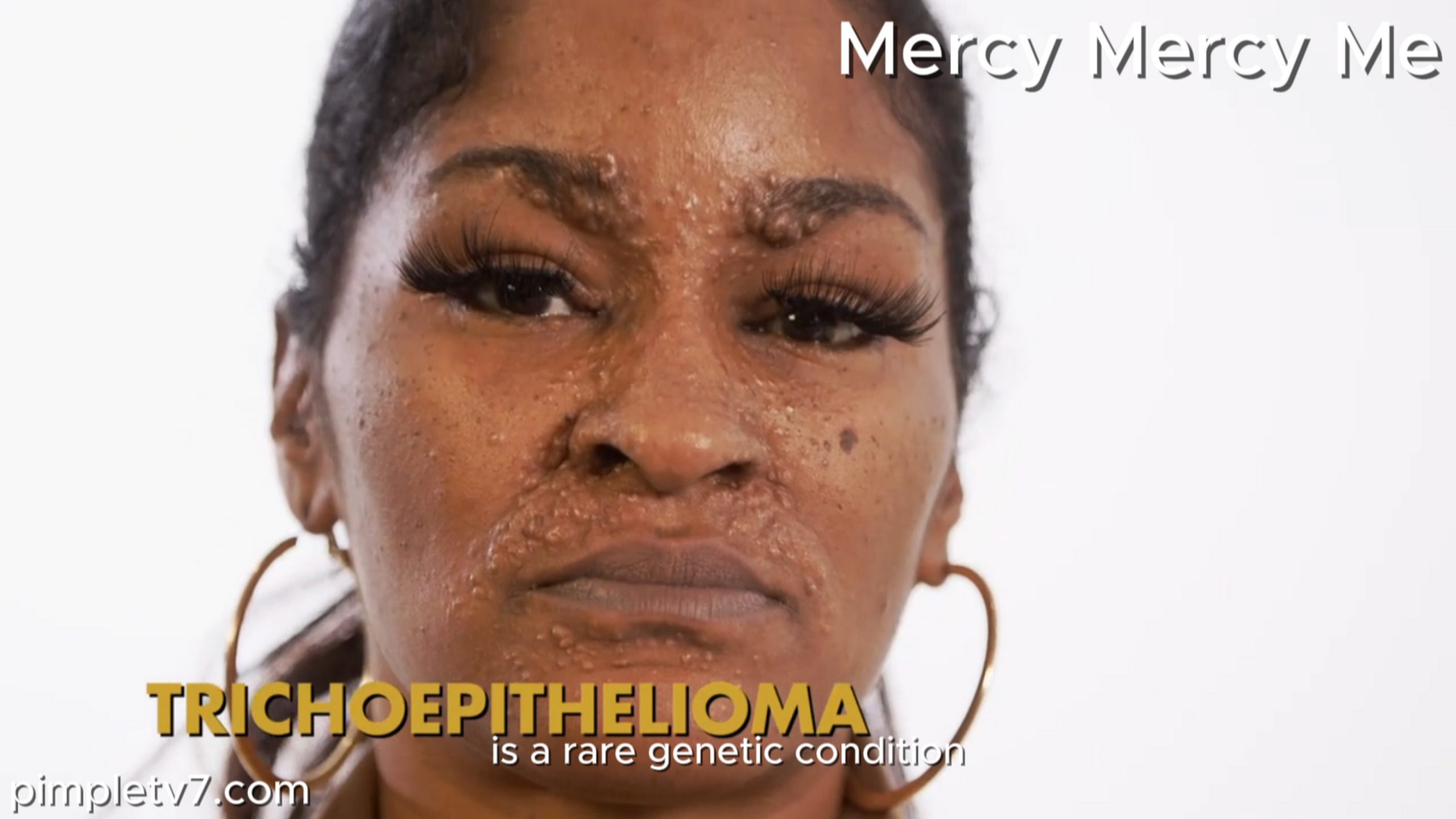 Cha comes to Dr. Mercy to help her gain her confidence back due to the bumps on her face. MercyMercyMe 220826