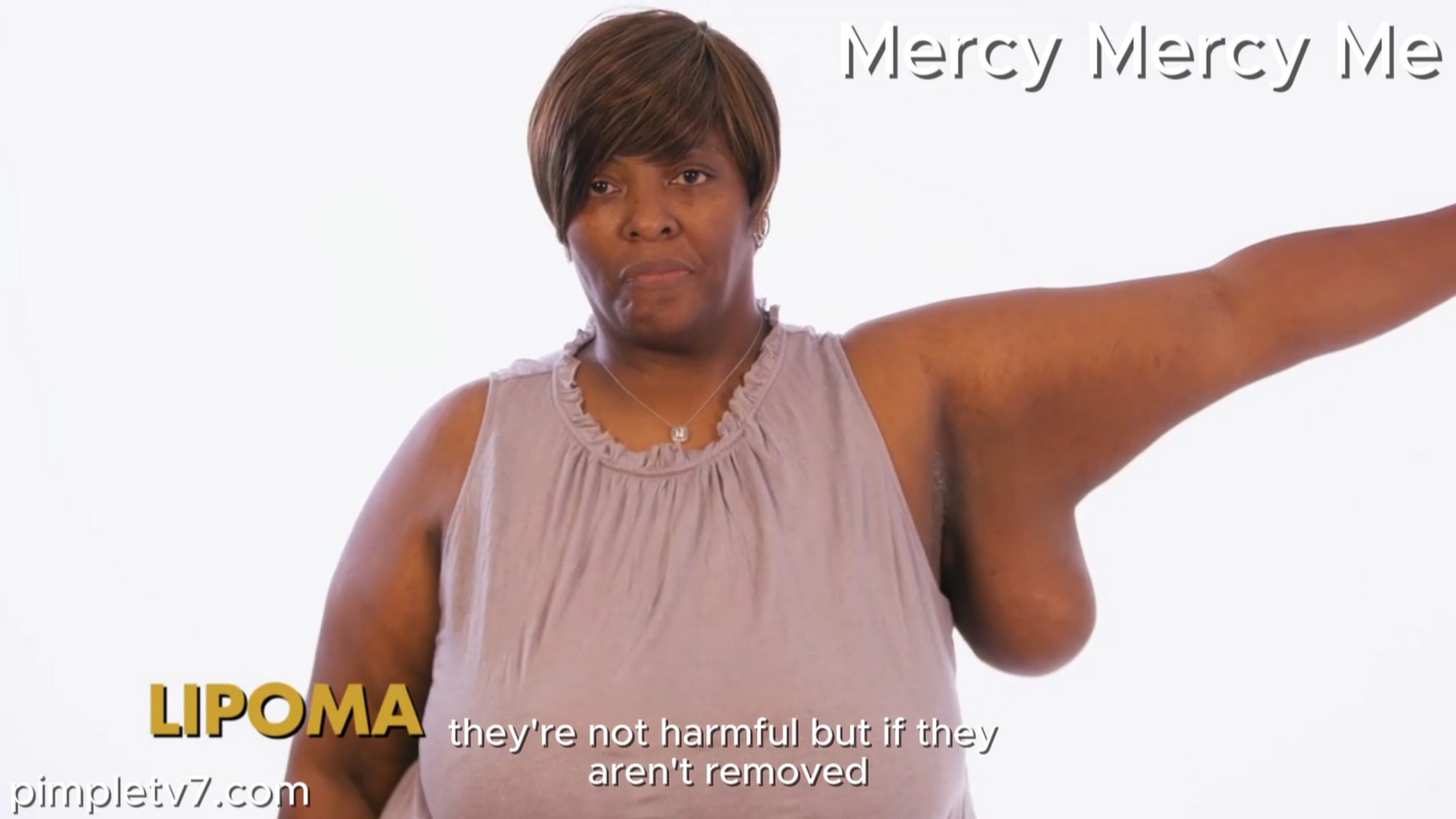 Chandra’s lipoma is weighing her down physically and emotionally. MercyMercyMe 260826