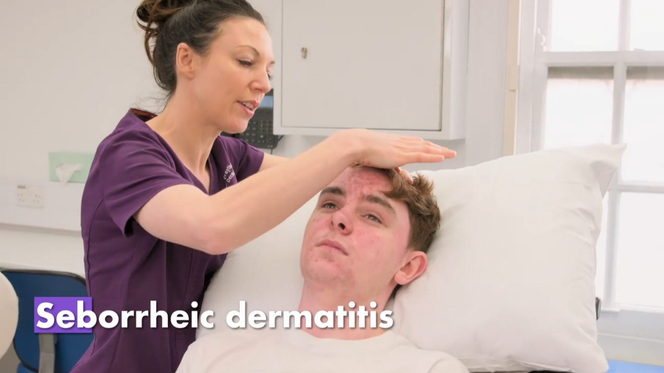 Connor’s acne makes him feel like a monster. SaveMySkin 190826