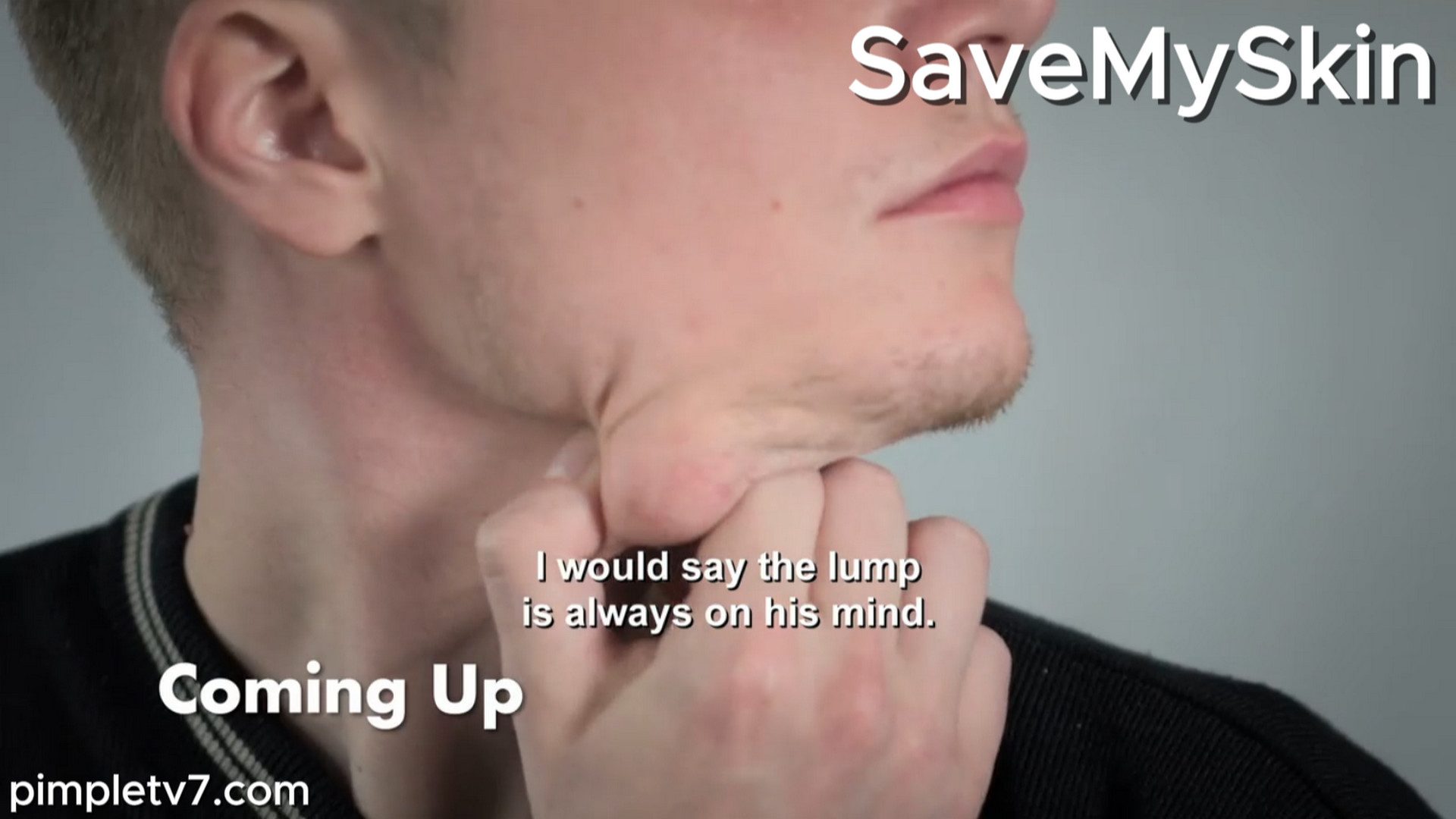Dillon doesn’t want to go to college with a lump under his chin. SaveMySkin 270826
