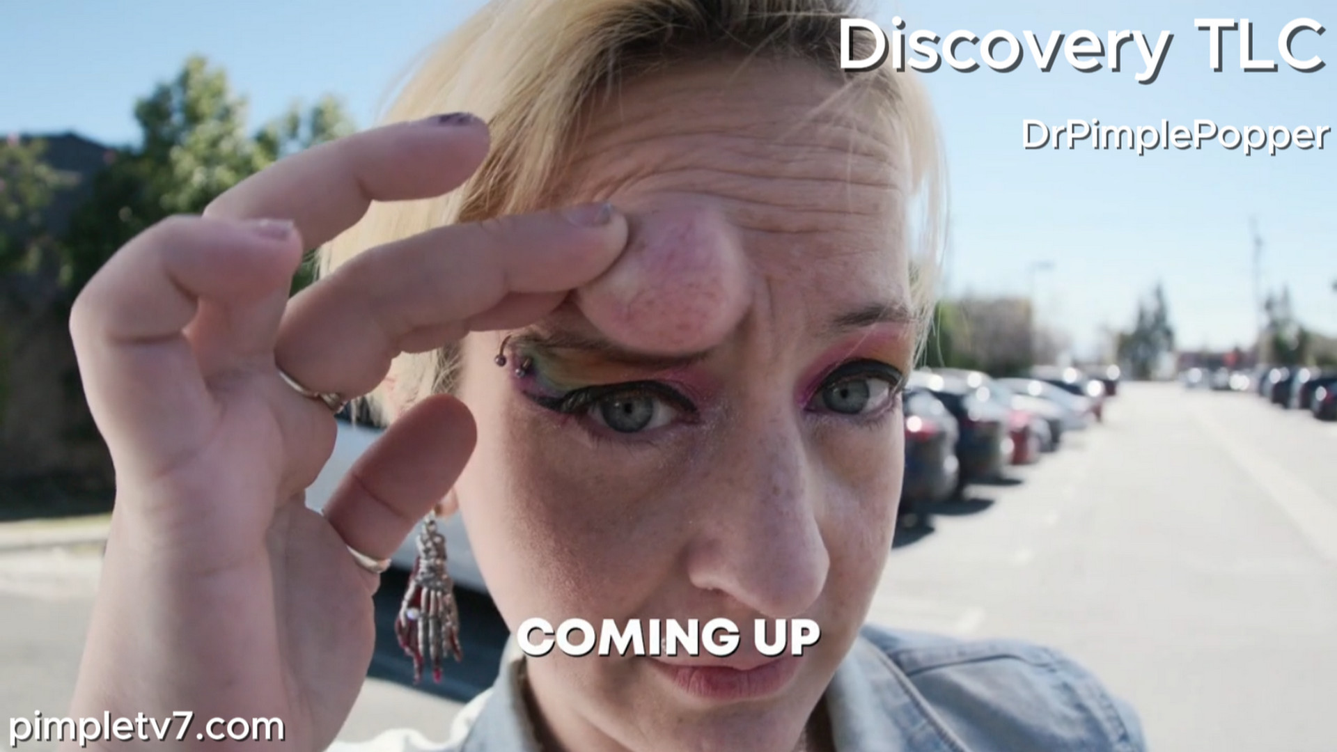 Krystal, a witch, looks to clear a curse of a cyst from her face. Dr. Pimple Popper 020826