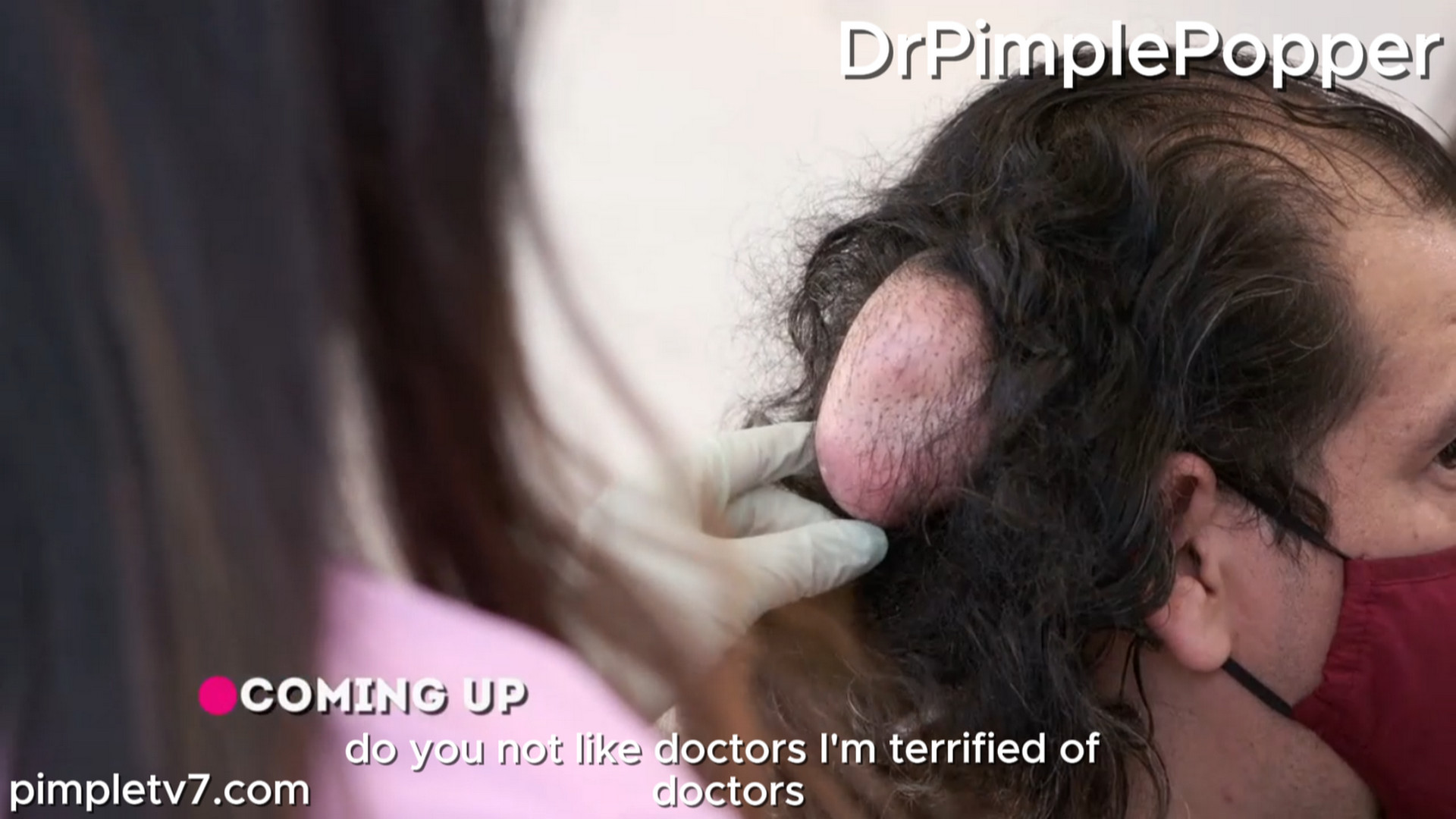 Leonardo has a fist-size growth on his head, but he is terrified of doctors. Dr. Pimple Popper 080826
