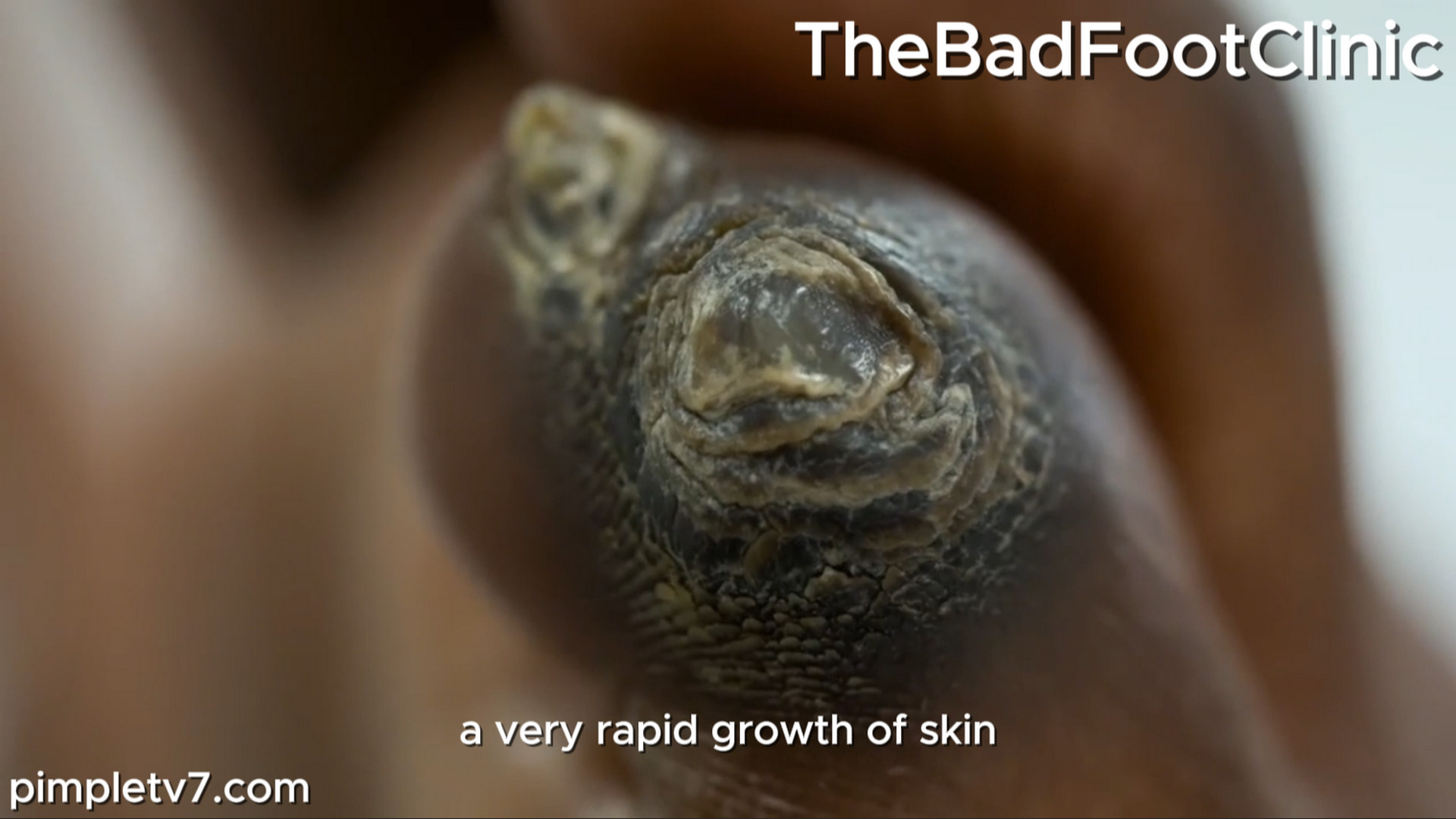 Marion plays sleuth when Liona comes to the clinic with painful corns. TheBadFootClinic 160826