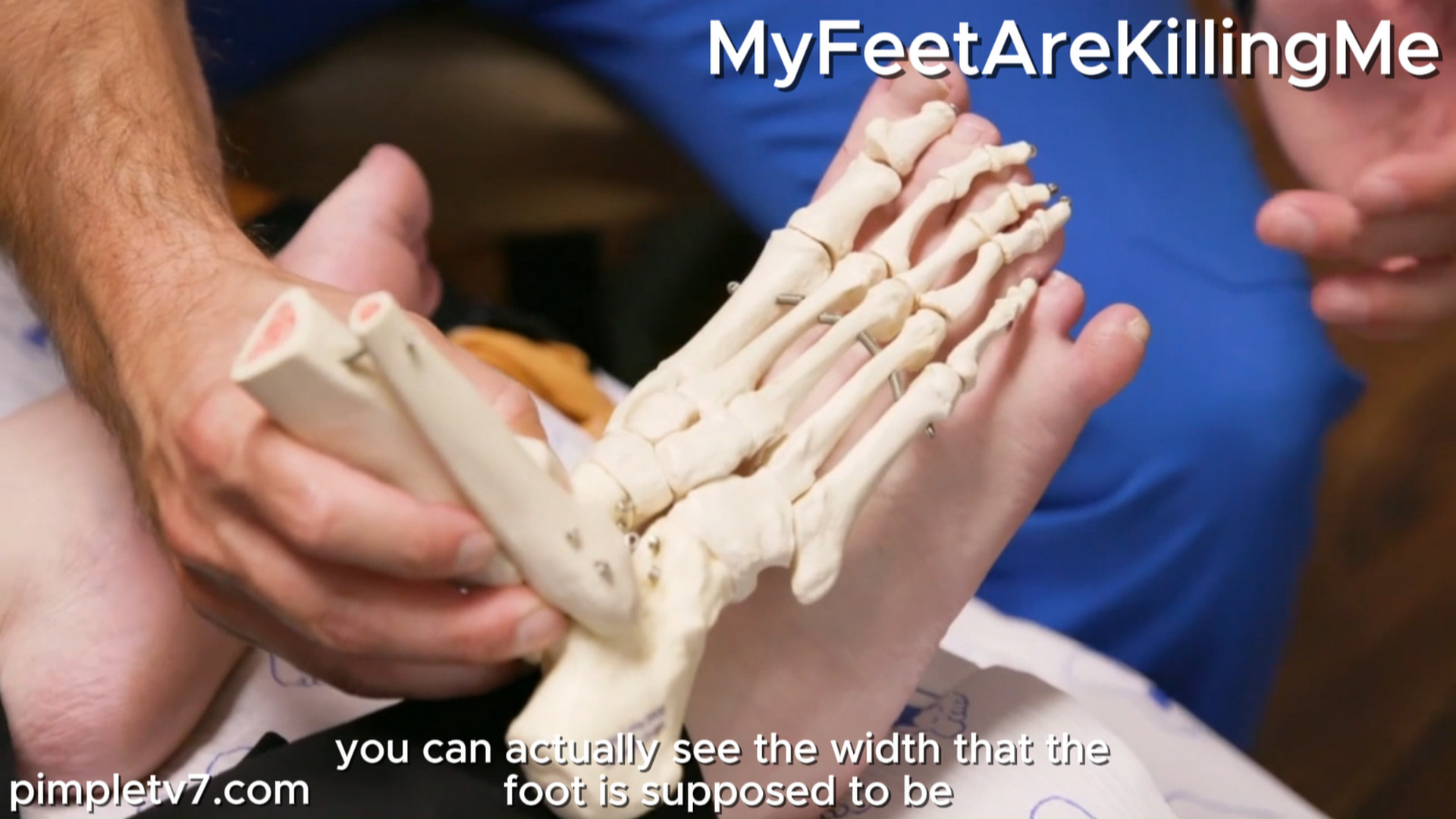 Morgan, an erotic paranormal romance novelist, is hoping to get her sixth toe amputated. MyFeetAreKillingMe 230826