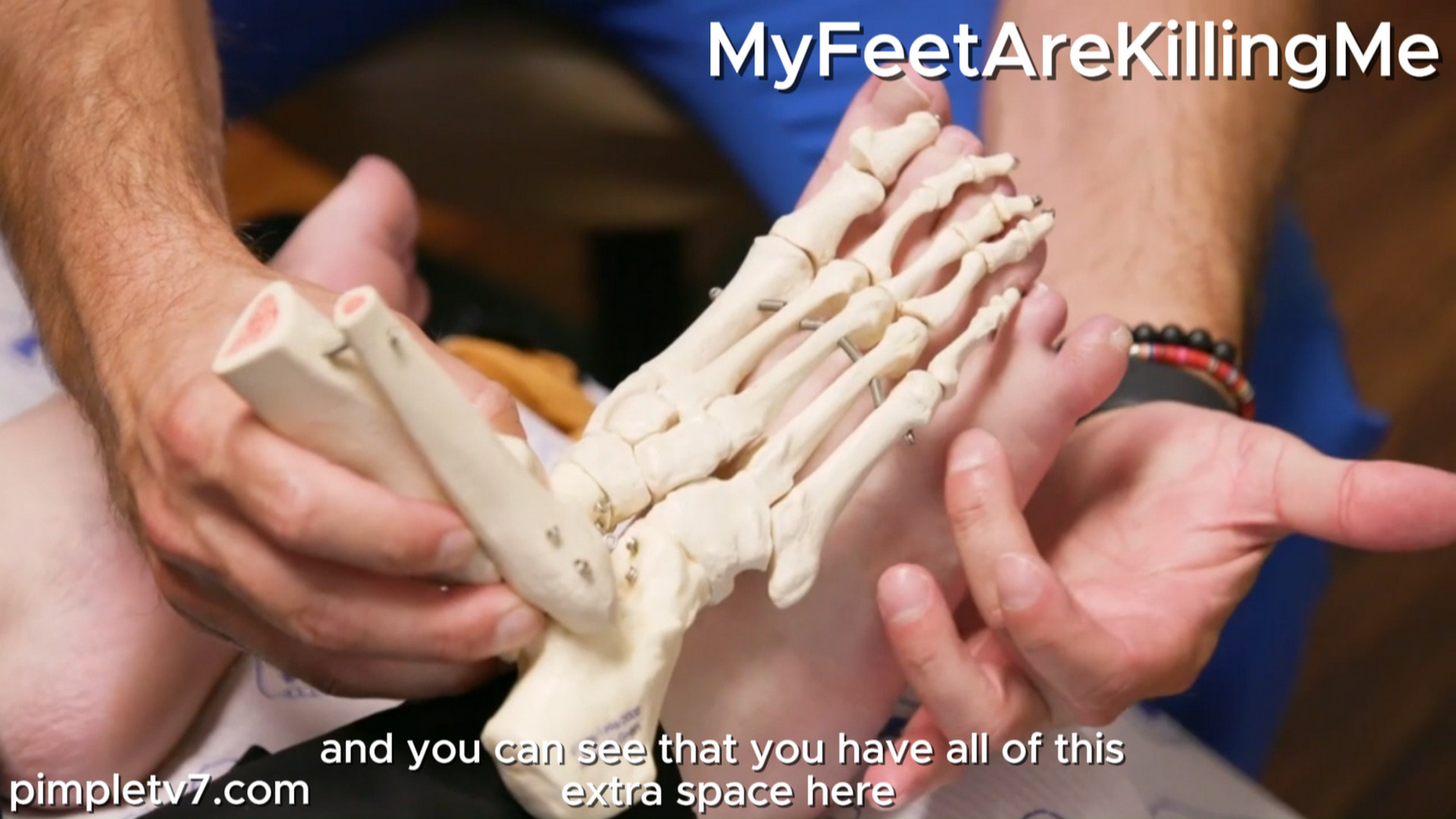 Morgan, an erotic paranormal romance novelist, is hoping to get her sixth toe amputated. MyFeetAreKillingMe 070826