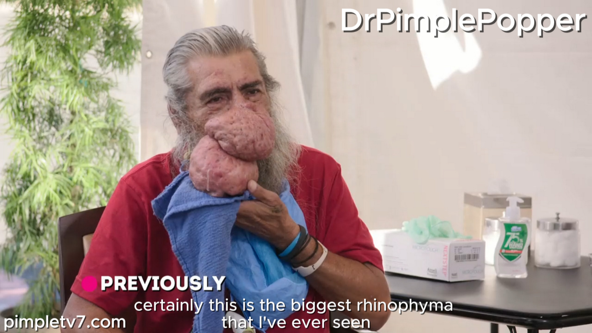 Roger returns with his gigantic nose growths in the hopes that Dr. Lee and her colleagues can help before it’s too late. Dr. Pimple Popper 070826