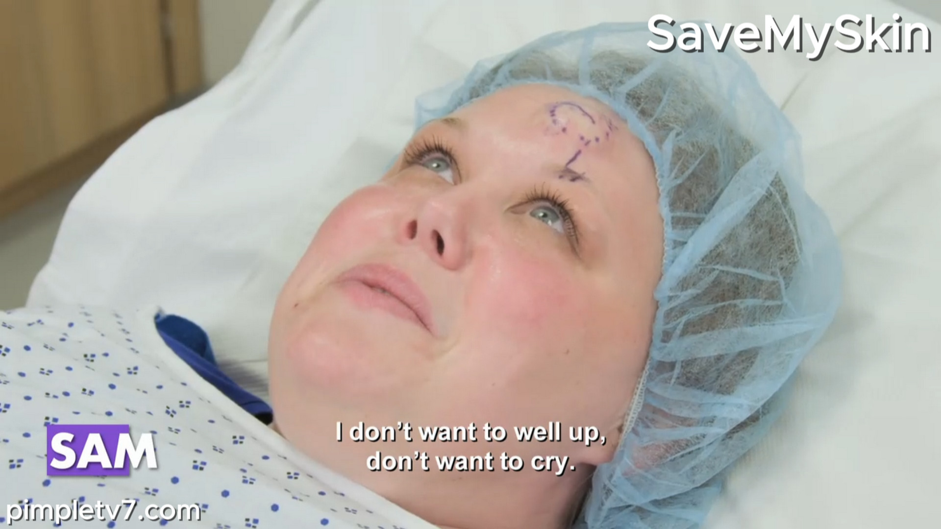 Sam would like a cyst removed from her forehead. SaveMySkin 310826