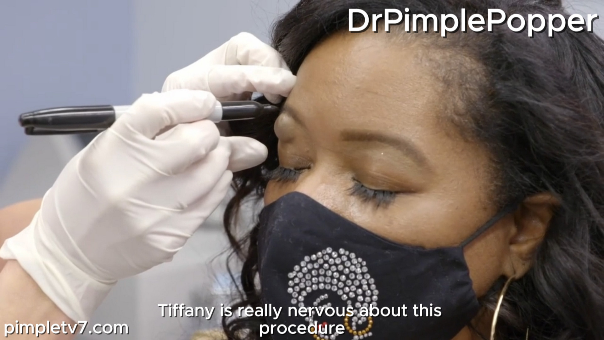 Tiffany has a recurring cyst on her eyelid. Dr. Pimple Popper 060826