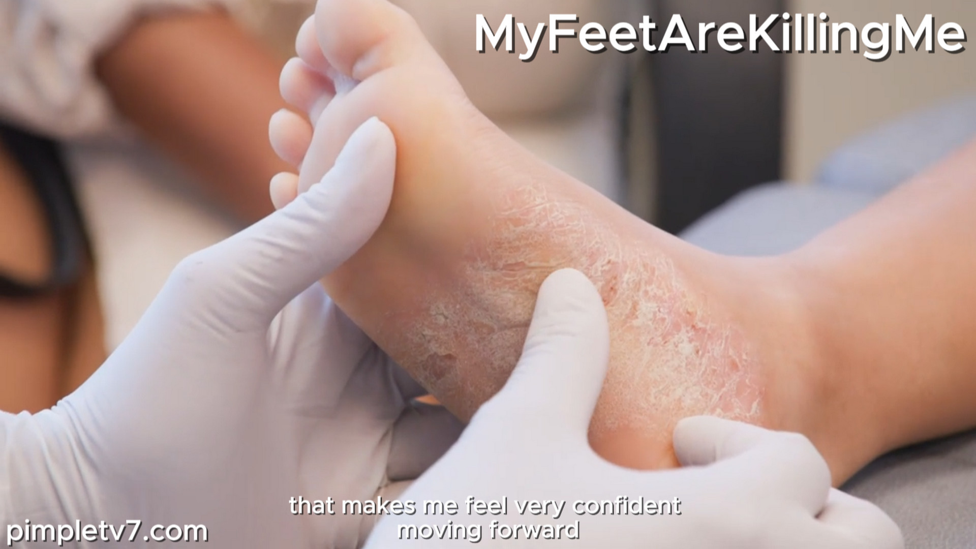 A boy with extremely itchy feet. MyFeetAreKillingMe 170926