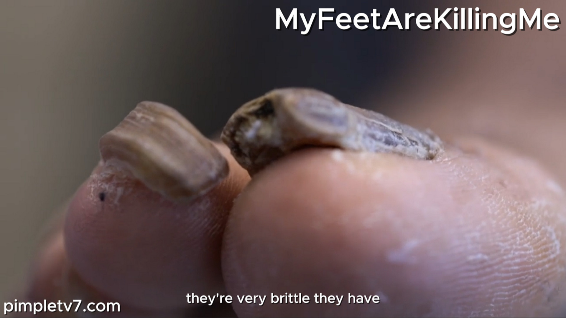 A guy that has “dead man’s feet” creates mysterious challenges for Dr. Brad and Dr. Ebonie. MyFeetAreKillingMe 190926