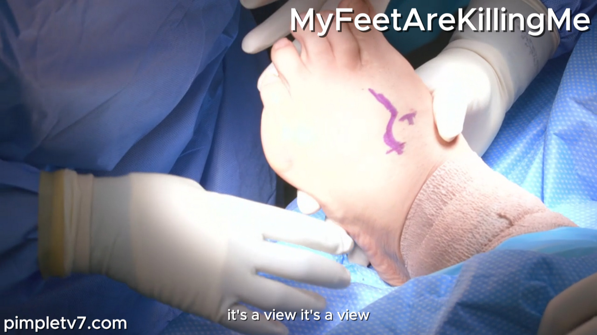 A man born with seven toes on each foot. MyFeetAreKillingMe 210926