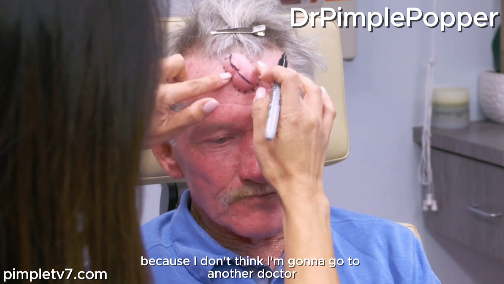 A man covers his big head growth with hats. Dr. Pimple Popper 210926