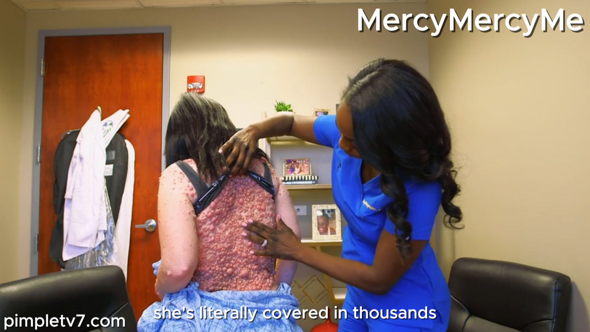 Ashley’s case of neurofibromatosis is one of the worst in the country. MercyMercyMe 230926