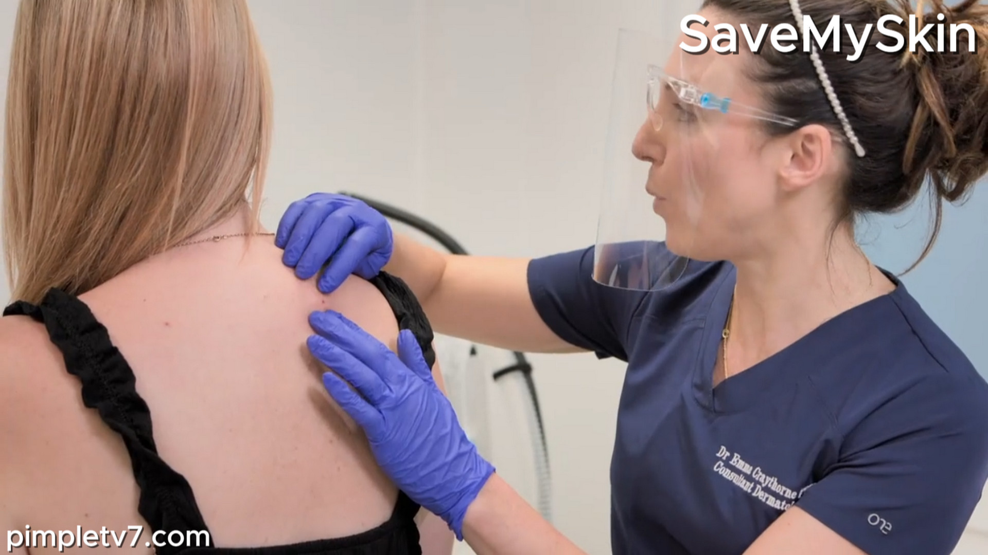 Carrie has a cyst that is destroying her confidence. SaveMySkin 080926