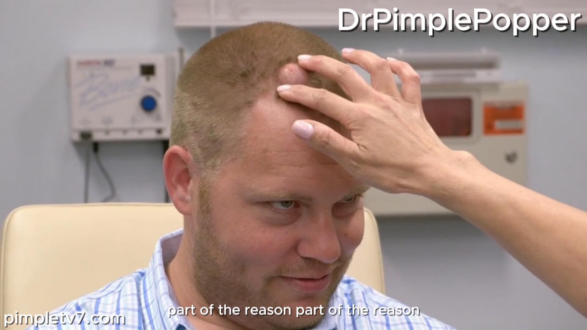 Chris suffers from psoriasis that nearly covers his body and a bump on his head. Dr. Pimple Popper 060926