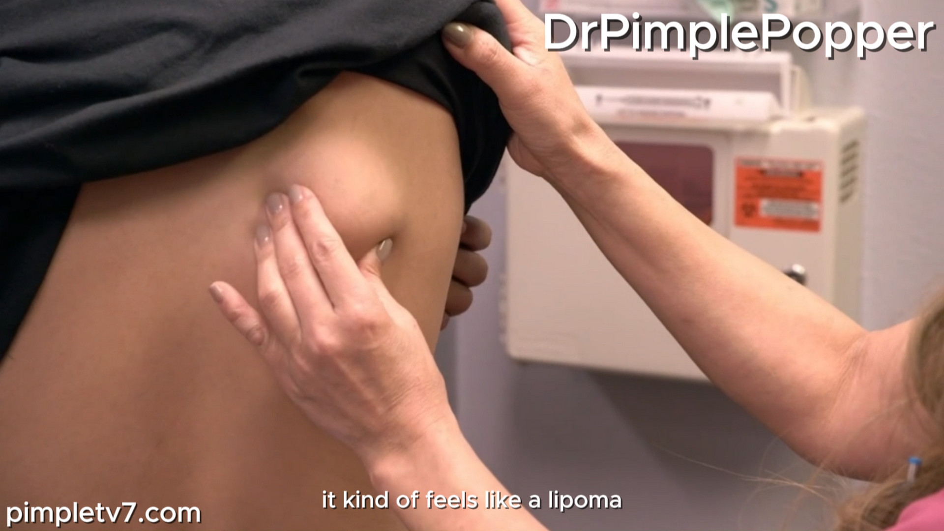 Christian & Jonathan have a lump on their back; it is about 3 inches wide. Dr. Pimple Popper 180926