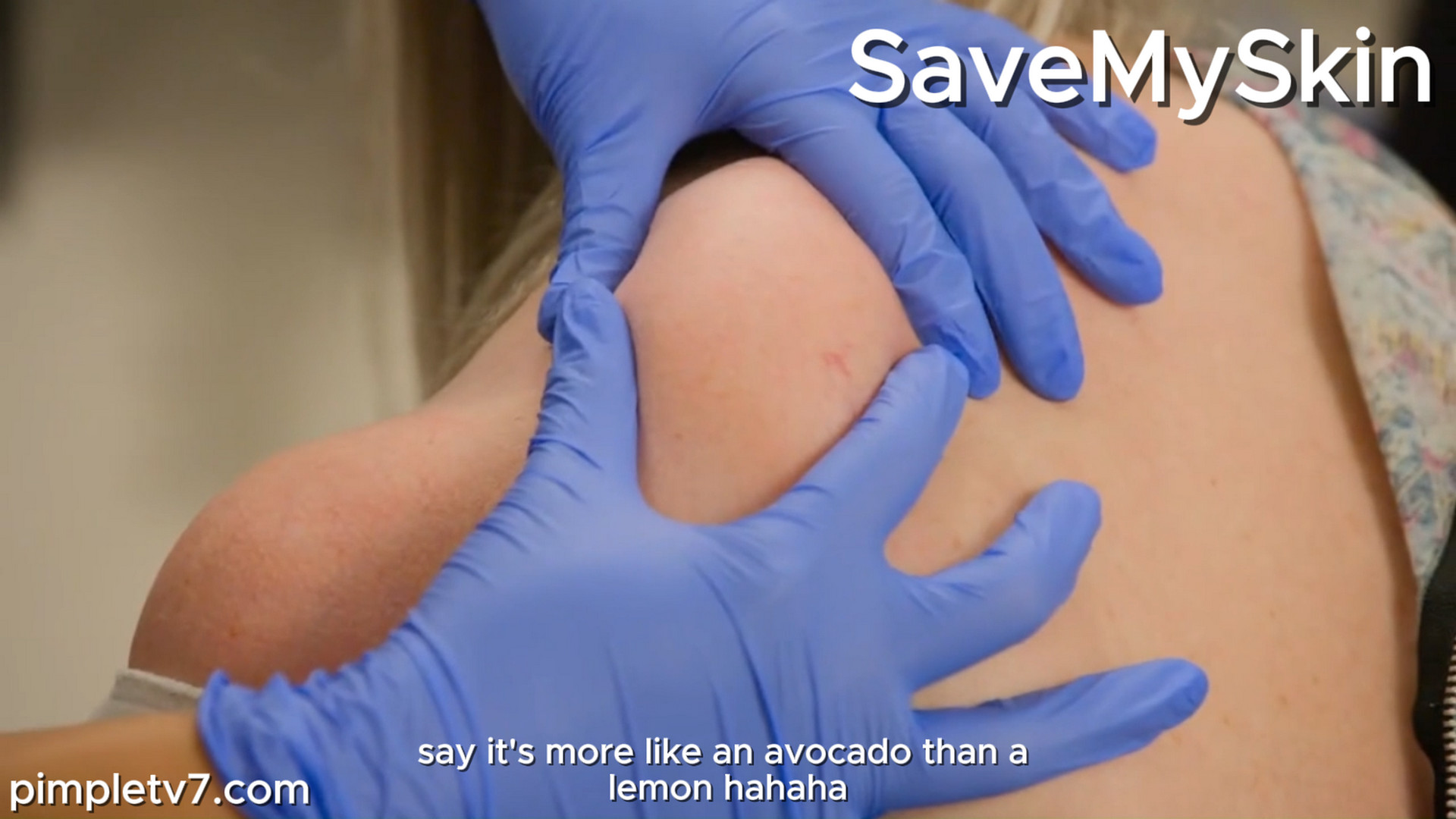 Dr. Emma is determined to find out why she has developed so many and to get them under control. SaveMySkin 160926