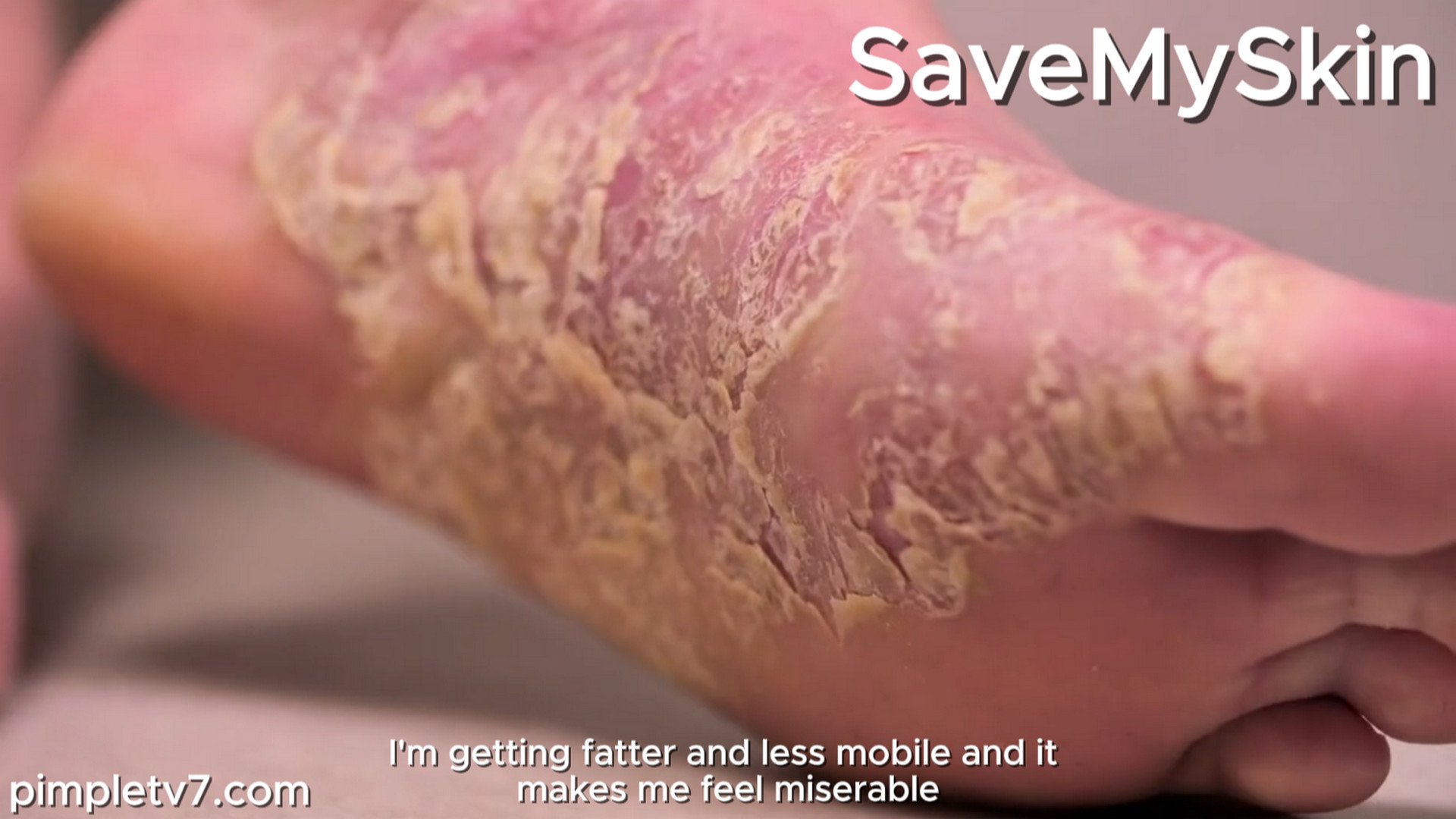 Dr. Emma steps in to help them with their skin. SaveMySkin 210926