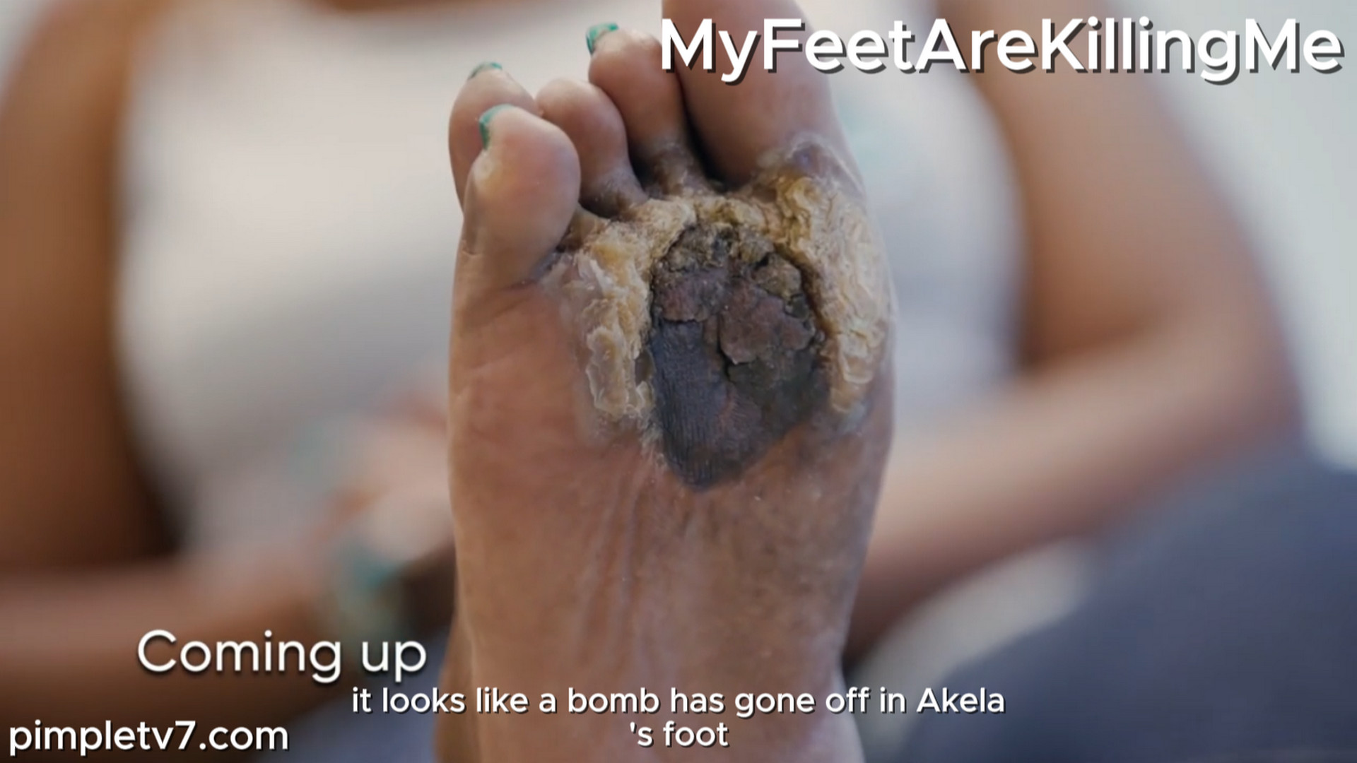 Dr. Ebonie has her hands full when she is visited by a woman with a foot she says is cursed. MyFeetAreKillingMe 220926