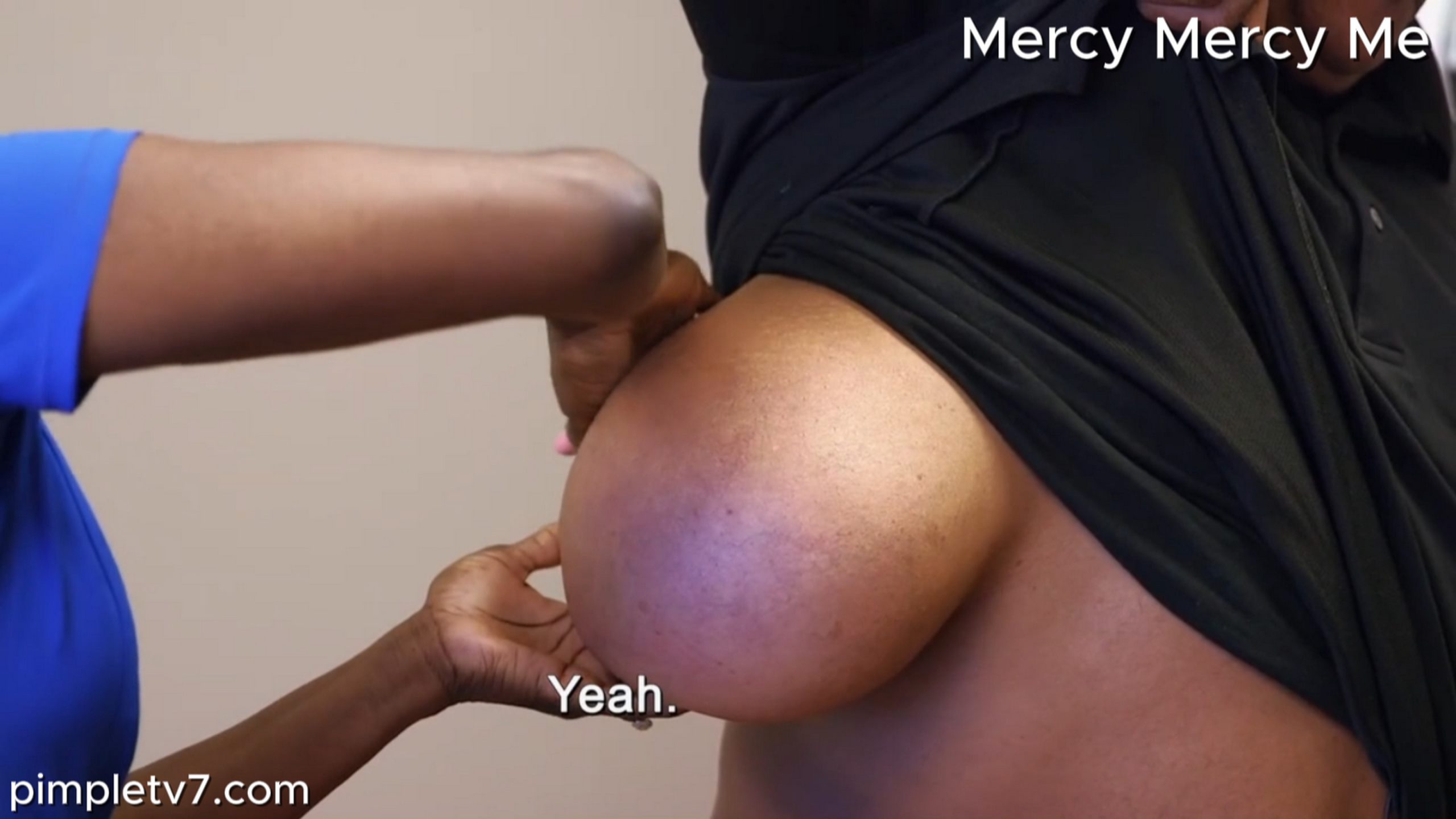 Dr. Mercy tries to remove Price’s lipoma, which is so big that it has gotten in the way of his relationship. MercyMercyMe 220926
