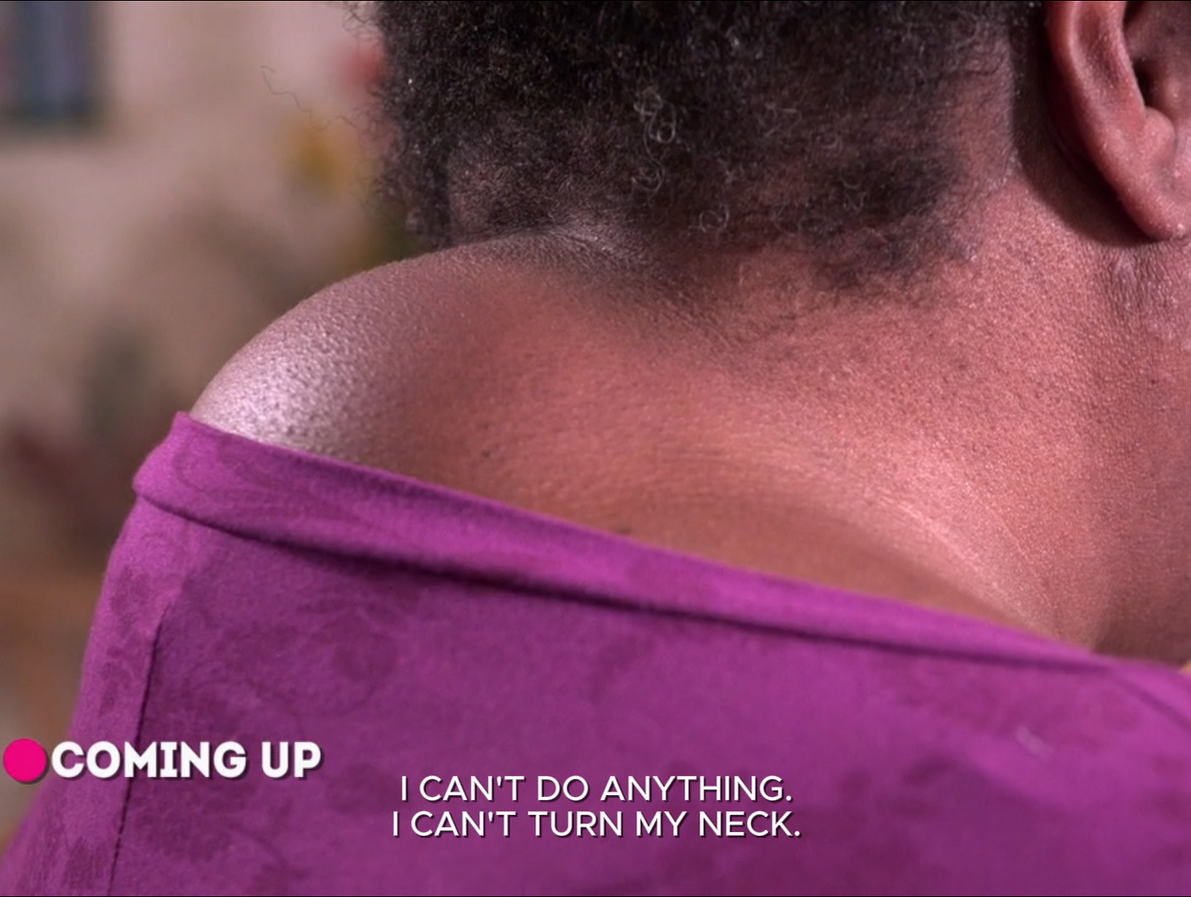 Dr. Sandra Lee helps Belinda, whose lump on her neck causes her to be immobile. Dr. Pimple Popper 010926