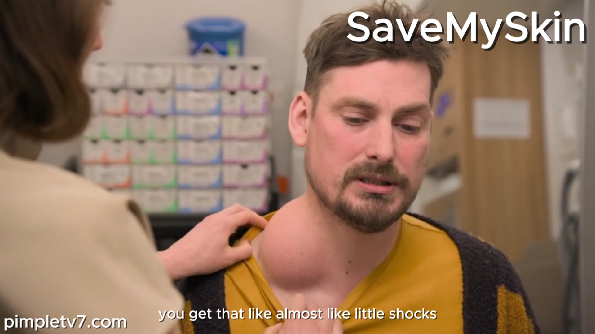 Paul has a large lump on his neck. It just seems so abnormal; it’s very awkward and uncomfortable; it’s just bizarre. Dr. Emma has ever seen. SaveMySkin 090926