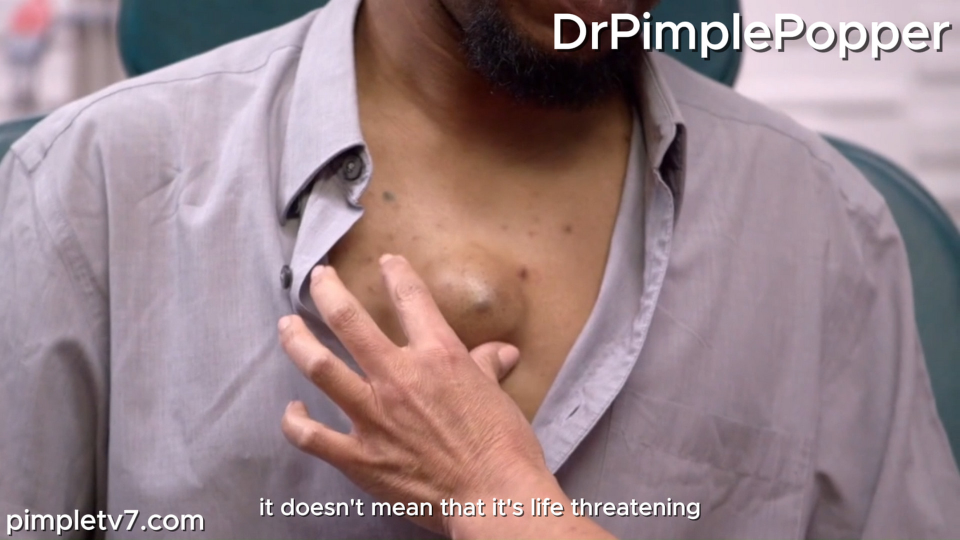 Victor has a lump in the middle of his chest. Dr. Pimple Popper 170926