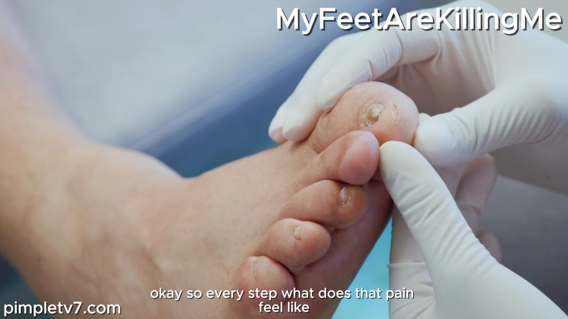 A man who broke his foot three times and never saw a doctor hopes Dr. Ebonie can provide him with some help. MyFeetAreKillingMe 041026