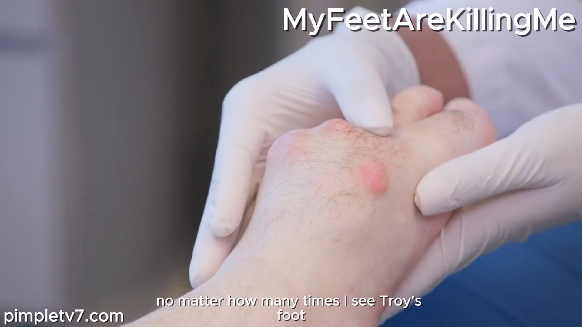 A man with a monstrous mystery growing on his foot. MyFeetAreKillingMe 181026