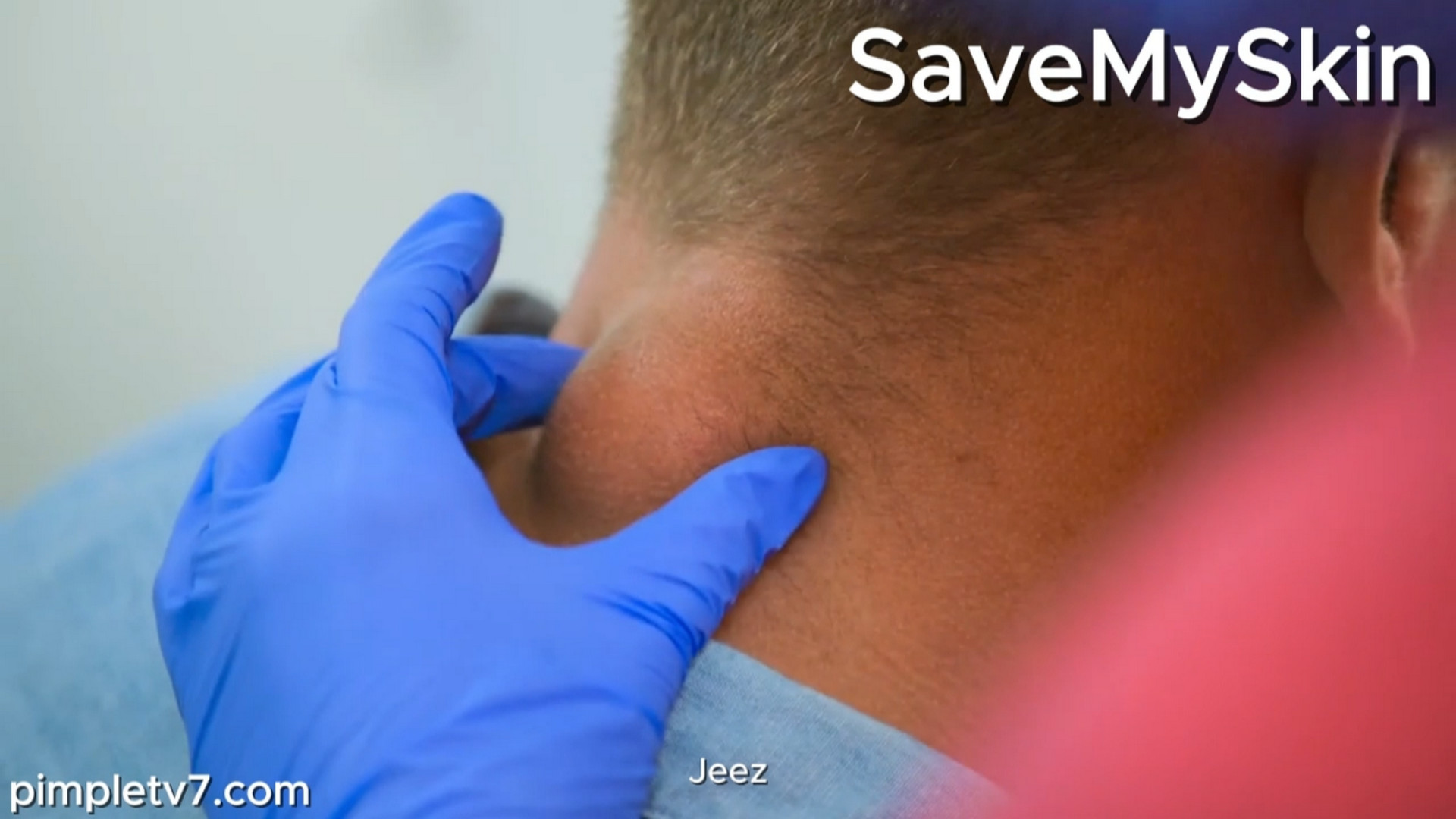 Ben must overcome his fear of needles to have his 12-year-old cyst removed. MercyMercyMe 021026