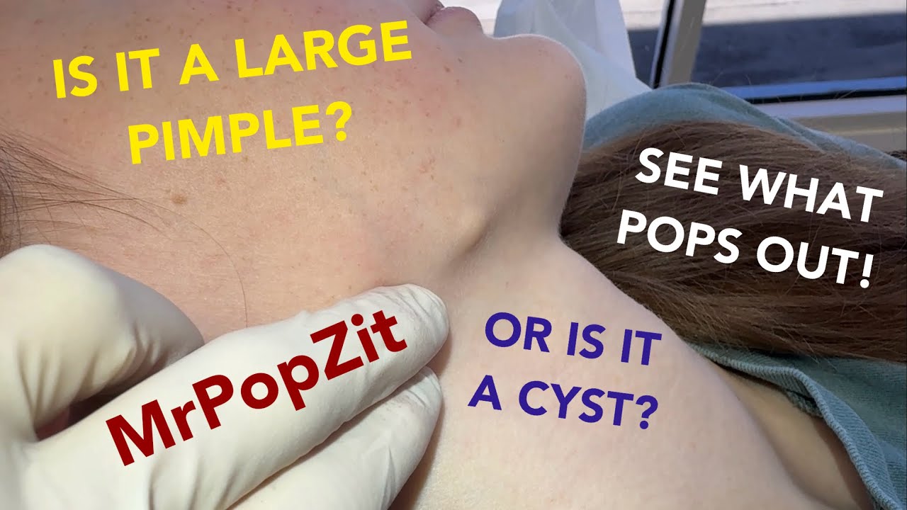 Can you see the face on what pops out!? Amazing pop! Just in time for school pics! Puppy face pop! Mr. PopZit 241026