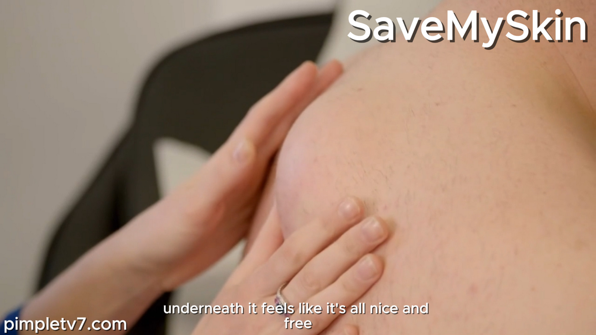 David’s lumps give Dr. Emma cause for concern. SaveMySkin 201026