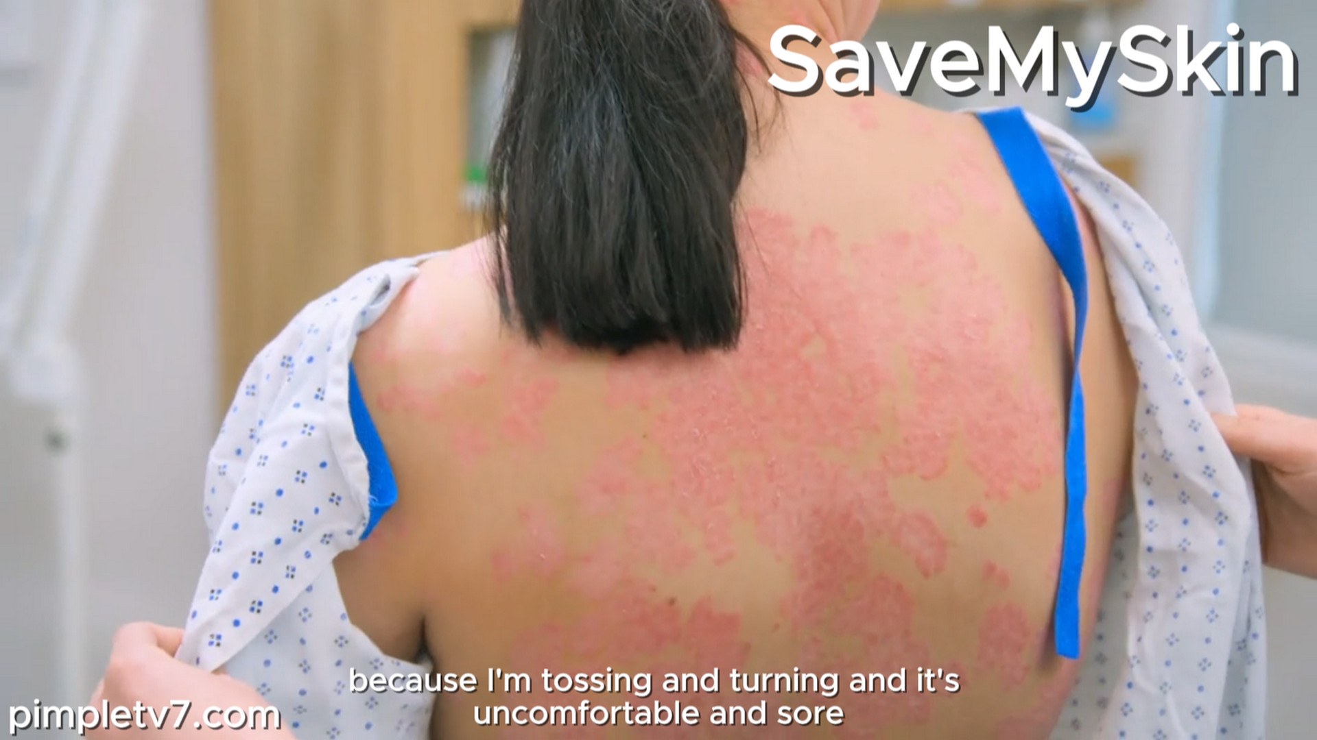 Dr. Emma has a shocking revelation about the creams she’s been using. SaveMySkin 011026
