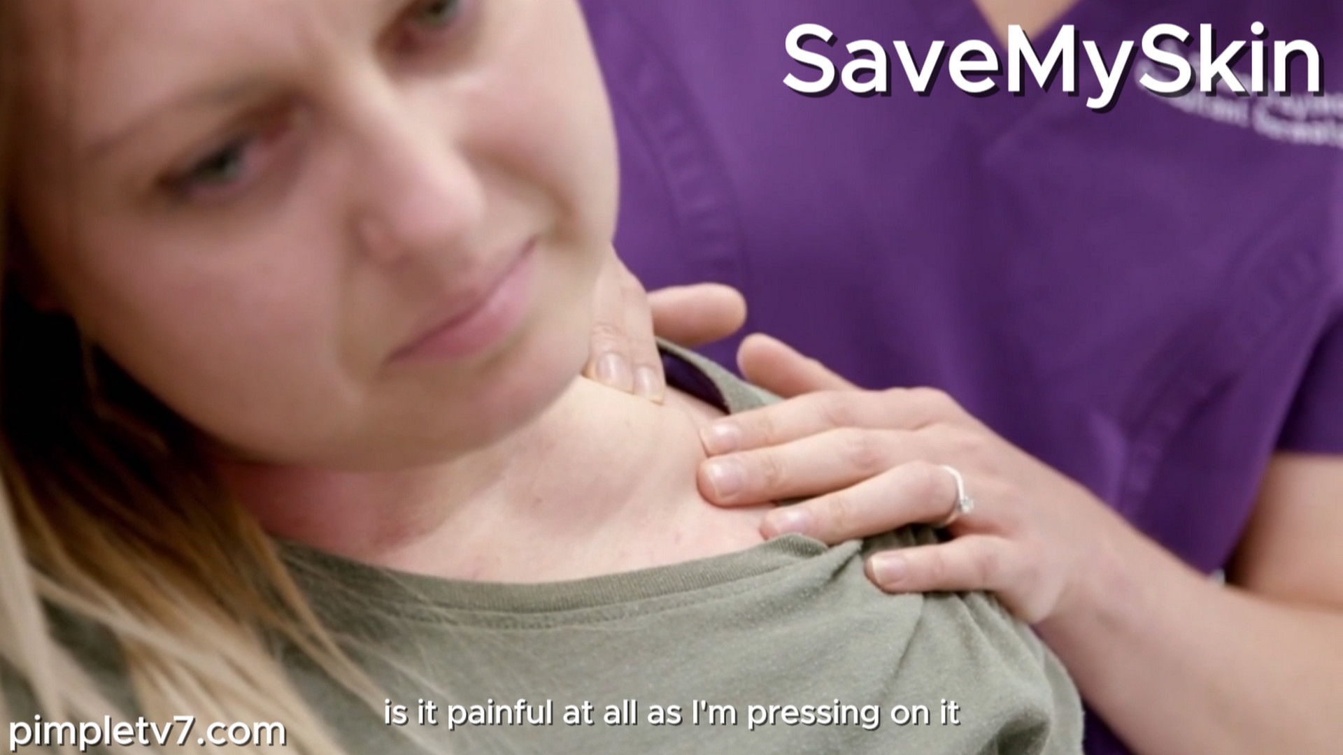 Gemma’s dream of having a baby is hampered by the lump on her shoulder. SaveMySkin 151026