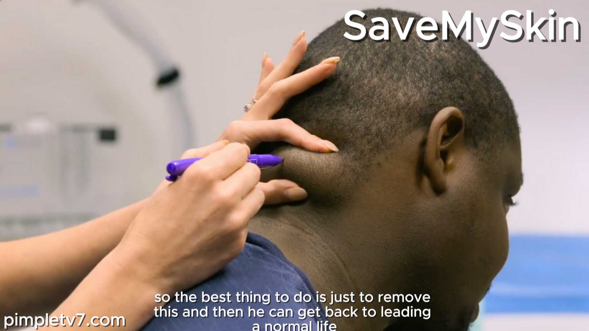 The lump on Opi’s neck is causing him a huge amount of pain, and he’s worried that it could be life-threatening. SaveMySkin 300926